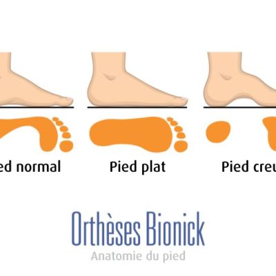 Anatomie d'un pied normal vs pied plat (appuie partout au sol) ou pied creux (appuie avant-pied et talon)
