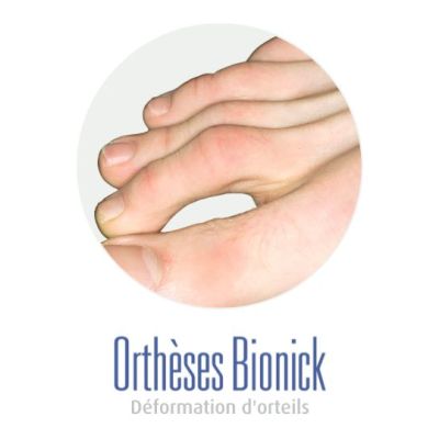 Orteils marteaux (un plat sous l'orteil comme un marteau) Orteils en griffe (comme un oiseau, qui se tient sur une branche)