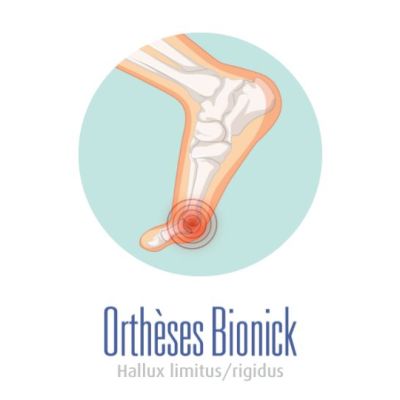 Mobilité réduite dans la première orteil