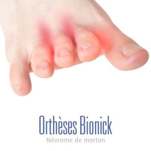 Nevrome_de_morton_pathologie_bionick (Demo)