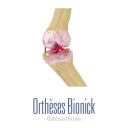 Osthéoarthrose d'un genou