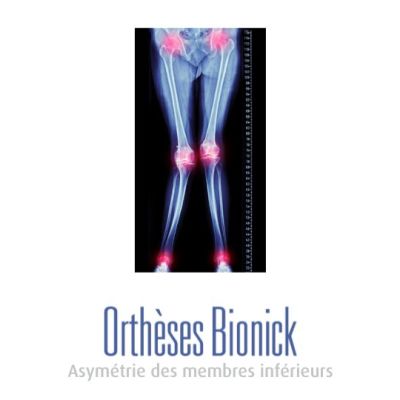 Asymétrie des membres inférieurs (jambe plus courte que l'autre)