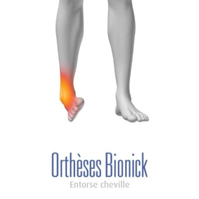 Entorse cheville, hyperextension des ligaments