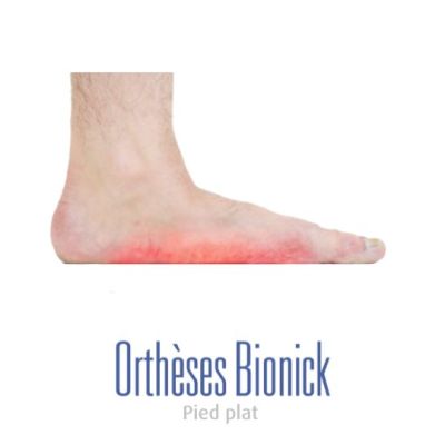 Pied affaisé de type plat