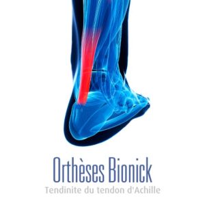 tendinite_achille (Demo)